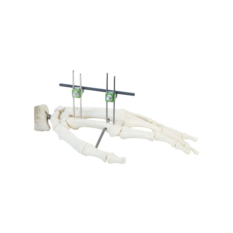 Phalanges of fingers & metacarpal bones frame (double-pin)